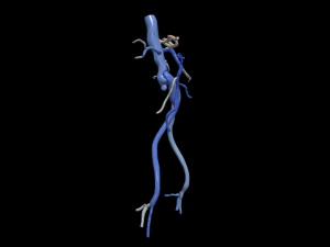 Aortofemoral 3D Model