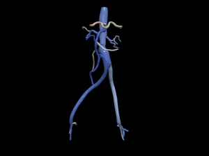 Aortofemoral 3D Model