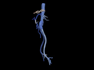 Aortofemoral 3D Model