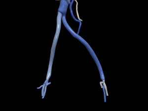 Aortofemoral 3D Model