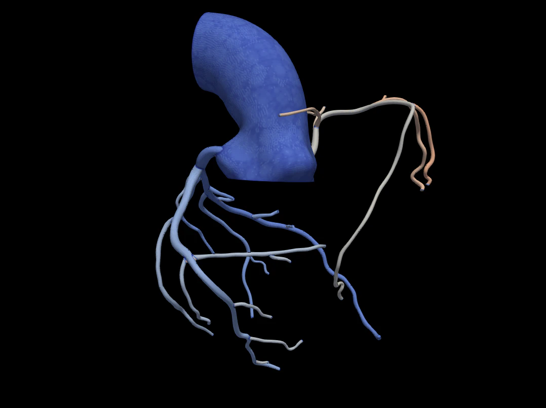 Coronary arteries 3D Model .c4d .max .obj .3ds .fbx .stl .blend 