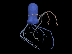 Coronary arteries 3D-Modell