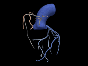 Coronary arteries 3D-Modell