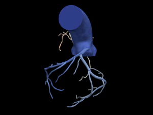 Coronary arteries 3D Model