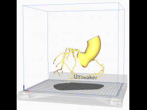 Coronary arteries 3D-Modell
