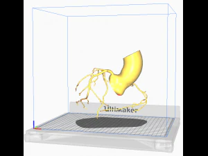 Coronary arteries 3D Model