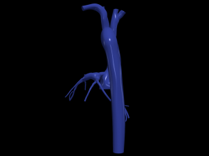Coronary arteries and aorta 3D 모델