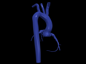 Coronary arteries and aorta 3D 모델