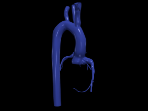 Coronary arteries and aorta 3D 모델