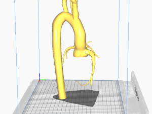 Coronary arteries and aorta 3D 모델