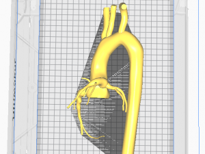 Coronary arteries and aorta 3D 모델