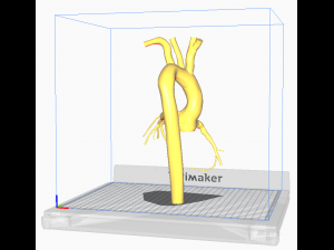 Coronary arteries and aorta 3D 모델