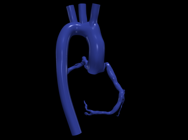 Coronary arteries and aorta Modelo 3D .c4d .max .obj .3ds .fbx .stl .blend 