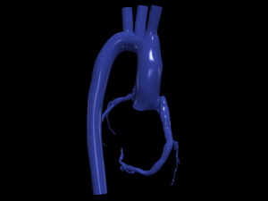 Coronary arteries and aorta Modelo 3D