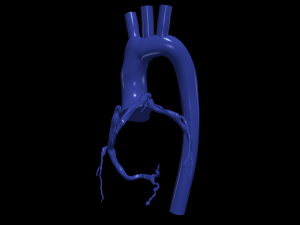Coronary arteries and aorta Modelo 3D