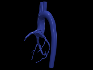 Coronary arteries and aorta Modelo 3D