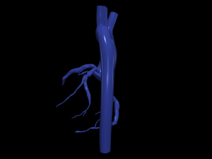 Coronary arteries and aorta Modelo 3D