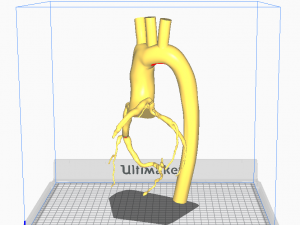 Coronary arteries and aorta Modelo 3D