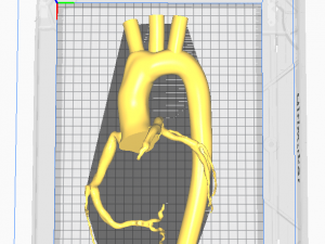 Coronary arteries and aorta Modelo 3D