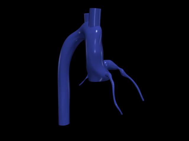 Coronary arteries and aorta 3D Model .c4d .max .obj .3ds .fbx .stl .blend 