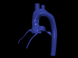 Coronary arteries and aorta 3D Model