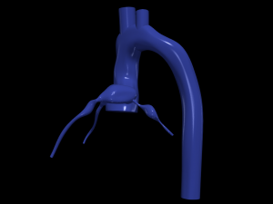 Coronary arteries and aorta 3D Model