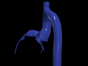 Coronary arteries and aorta 3D Model