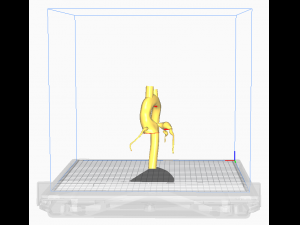 Coronary arteries and aorta 3D Model