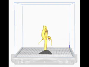 Coronary arteries and aorta 3D Model