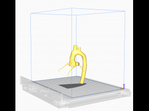 Coronary arteries and aorta 3D Model