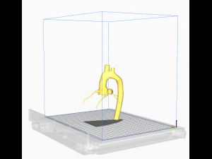 Coronary arteries and aorta 3D Model