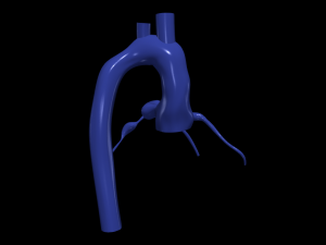 Coronary arteries and aorta 3D Model