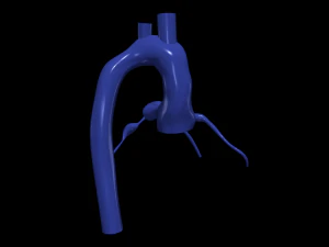 Coronary arteries and aorta 3D Model