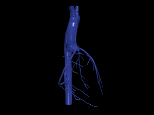 Coronary arteries and aorta 3D Model