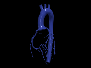 Coronary arteries and aorta 3D Model