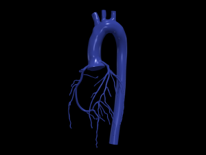 Coronary arteries and aorta 3D Model