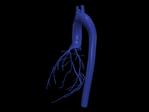 Coronary arteries and aorta 3D Model