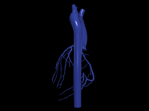 Coronary arteries and aorta 3D Model