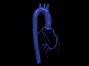 Coronary arteries and aorta 3D Model