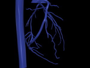 Coronary arteries and aorta 3D Model