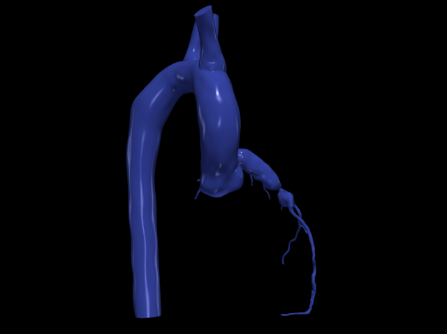 Coronary arteries and aorta Modelo 3D .c4d .max .obj .3ds .fbx .stl .blend 