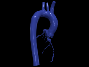Coronary arteries and aorta Modelo 3D