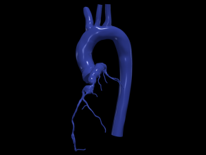 Coronary arteries and aorta Modelo 3D