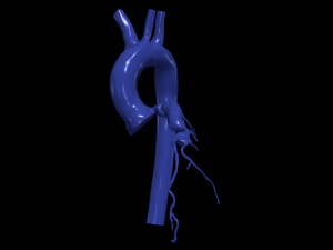 Coronary arteries and aorta Modelo 3D