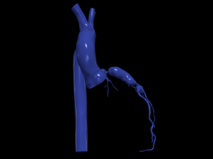 Coronary arteries and aorta Modelo 3D