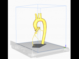 Coronary arteries and aorta Modelo 3D