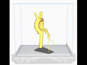 Coronary arteries and aorta Modelo 3D