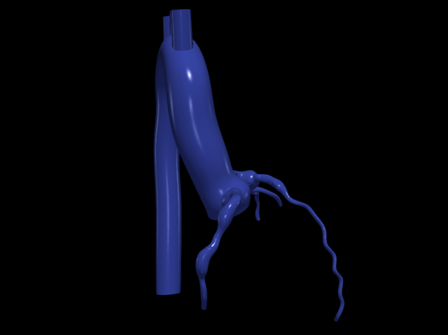 Coronary arteries and aorta Modèle 3D .c4d .max .obj .3ds .fbx .stl .blend 