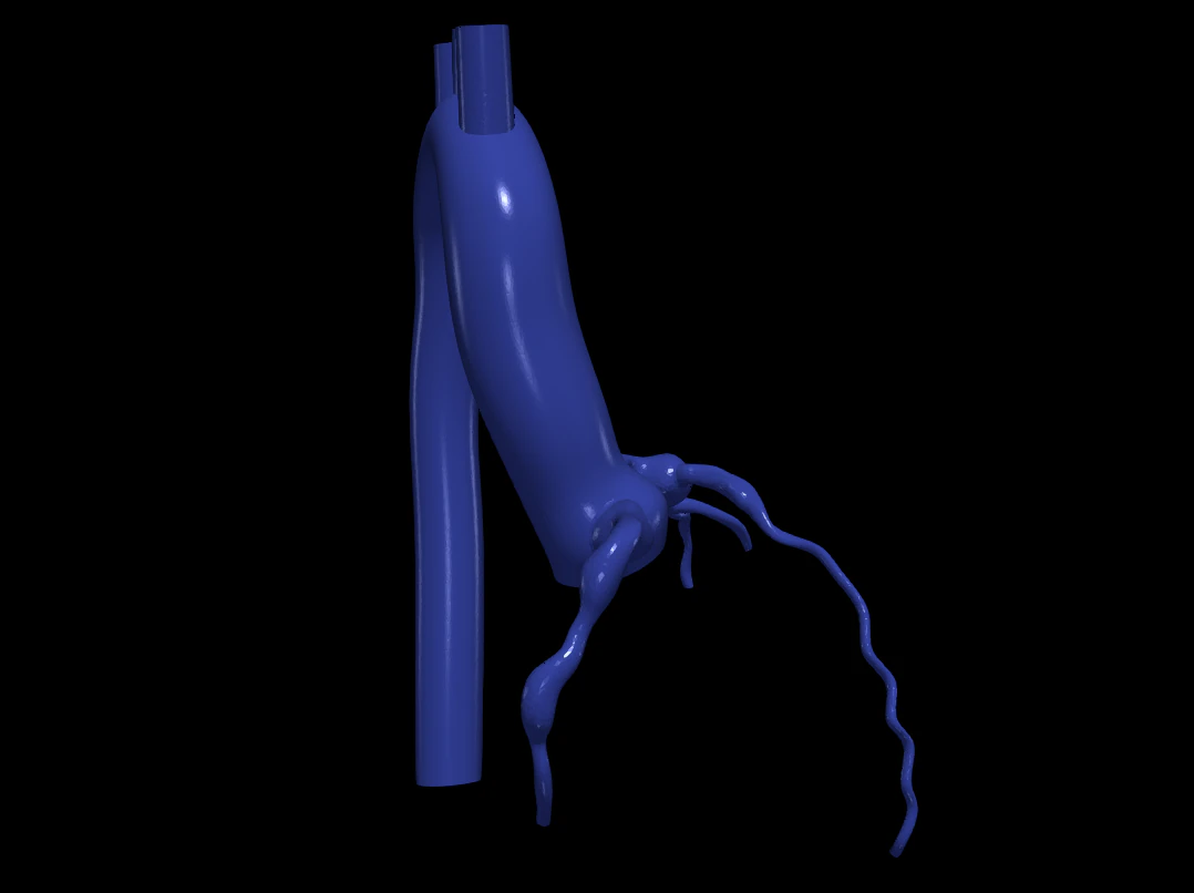 Coronary arteries and aorta 3D Model .c4d .max .obj .3ds .fbx .stl .blend 