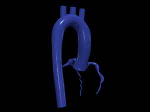 Coronary arteries and aorta 3D Model